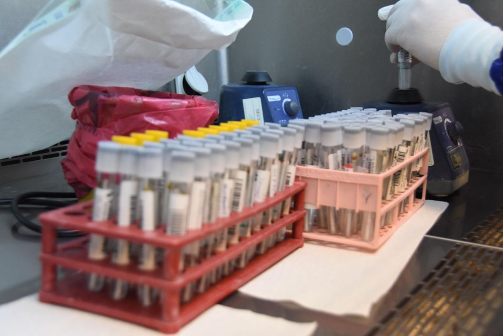Mutated corona virus cases are detected in 40 minutes - 21