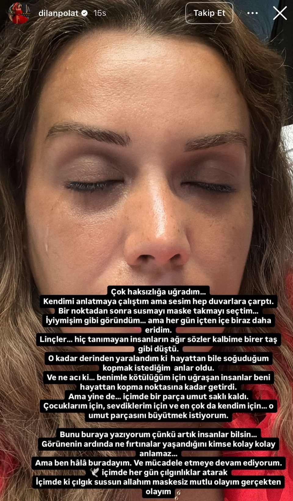 Dilan Polat psikiyatri kliniğine yattı - 1