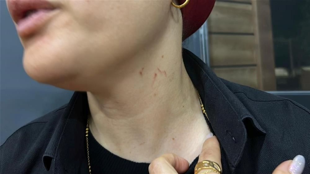 Düğünde halay başı kavgası | Kadın şarkıcıya saldırdı: "On parmağı birden boğazımdaydı" - 5