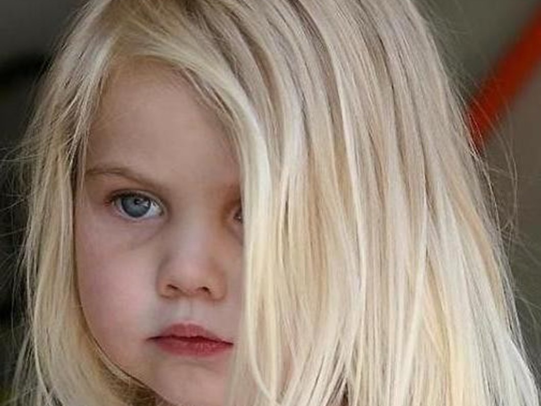 Kekeleyen Cocuga Yaklasim Nasil Olmali Saglik Haberleri Ntv