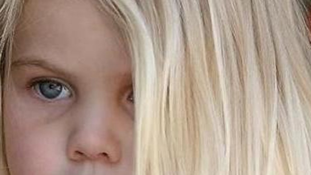 Kekeleyen Cocuga Yaklasim Nasil Olmali Saglik Haberleri Ntv