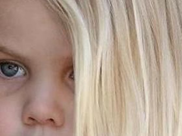 Kekeleyen Cocuga Yaklasim Nasil Olmali Saglik Haberleri Ntv