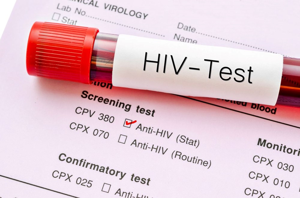 Covid-19 ile enfekte olan HIV/AIDS hastası vücudunda 21 mutasyon geliştirdi - 5