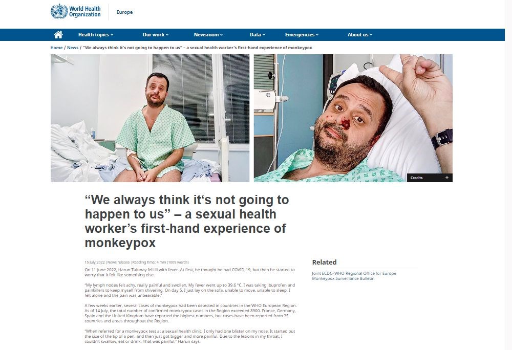 Dünyanın konuştuğu hasta: Önce HIV ve Covid sonra da maymun çiçeği - 6