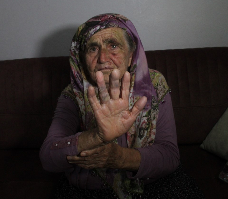 Adana'da 80 yaşındaki kadın evinde saldırıya uğradı - 1