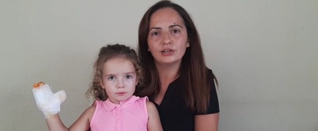 Uçan balon yaraladı NTV