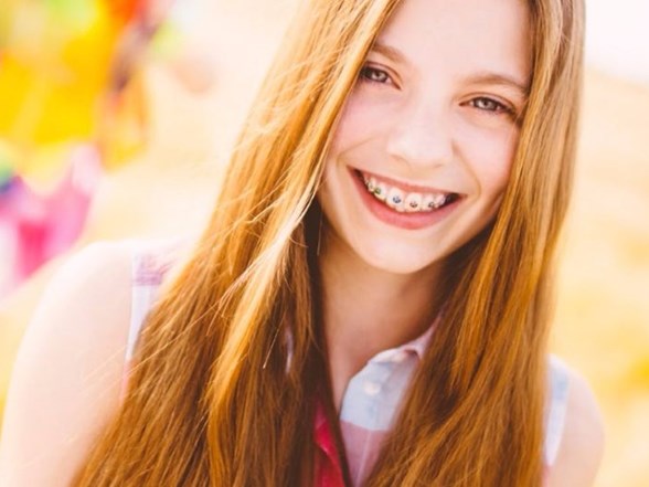 ortodontik tedavi icin kalici dislerin