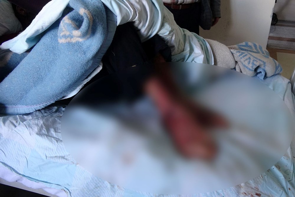 Covid sonrası yüzü çürümeye başladı, aile yardım istedi - 4