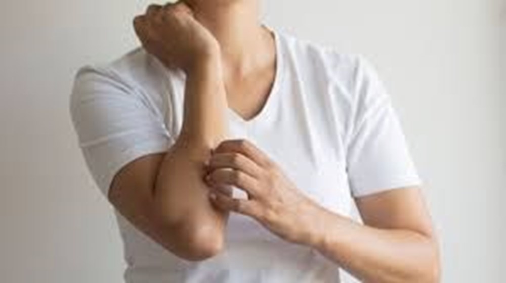 Uyuz vakaları yeniden artışa geçti: Kıyafetler, sosyal çevre ve ev ortamı dezenfekte edilmeli - 3