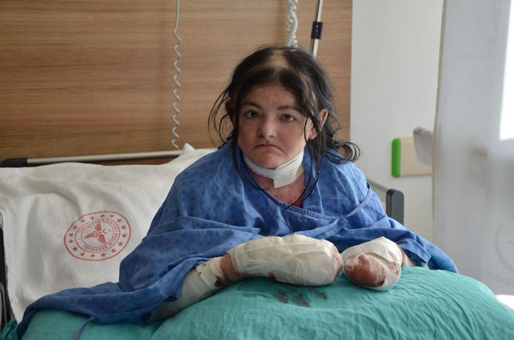 20 yıldır parmaklarını kullanamıyordu: Amerikalı Arias Türkiye'de şifa buldu 72 KSgoPZB 0eZGDPdEQuk3Q