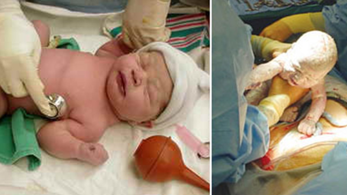 sezaryen bebegin dna sini degistiriyor mu saglik haberleri ntv