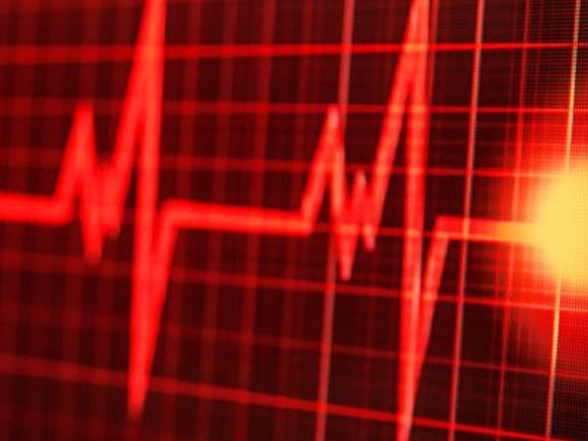 Atriyal Fibrilasyon Ne Zaman Tehlikeli Olur Kalpte Ritim Bozukluguna Dikkat Saglik Haberleri Ntv