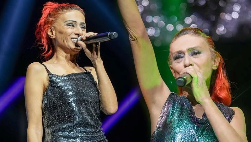 Yıldız Tilbe'nin yüzüne ne oldu?