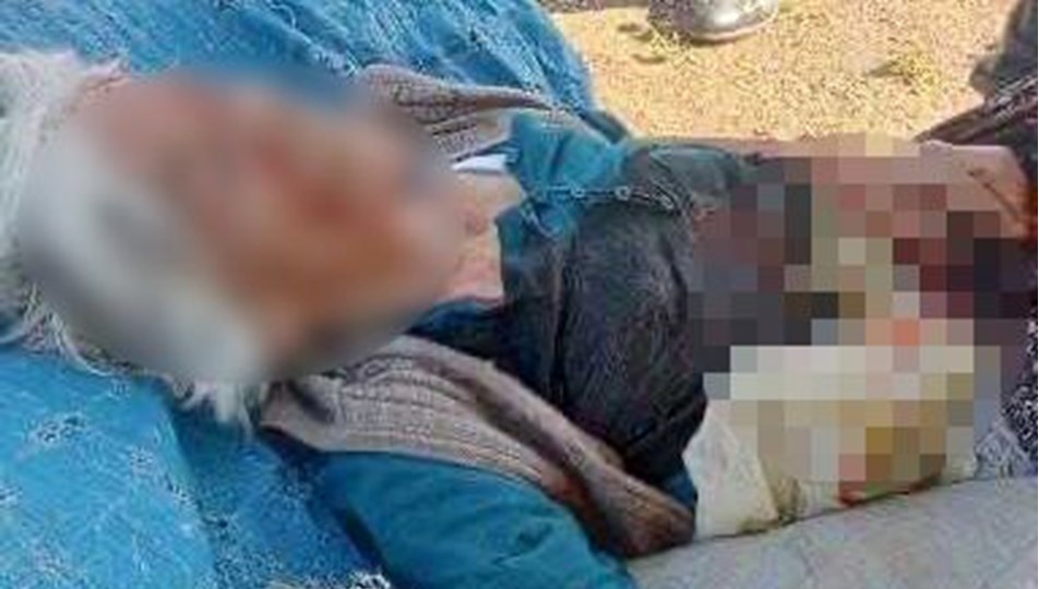 Sahipsiz köpeklerin saldırdığı yaşlı kadın ağır yaralandı