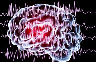 epilepsi nedir semptomlari nelerdir