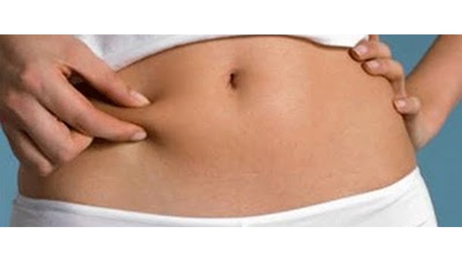 Liposuction ile alınan yağlar kollarda birikiyor