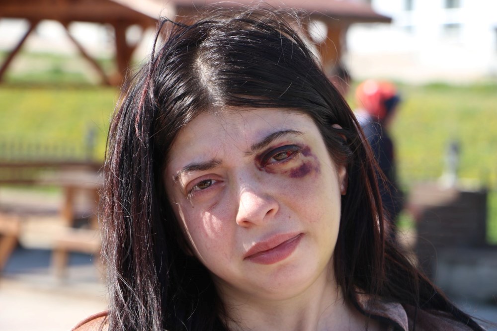 Sokak Terörü Diyeti: Tacizin Ardından Damla'nın Üç Aylık Sıvı Beslenme Mücadelesi 76