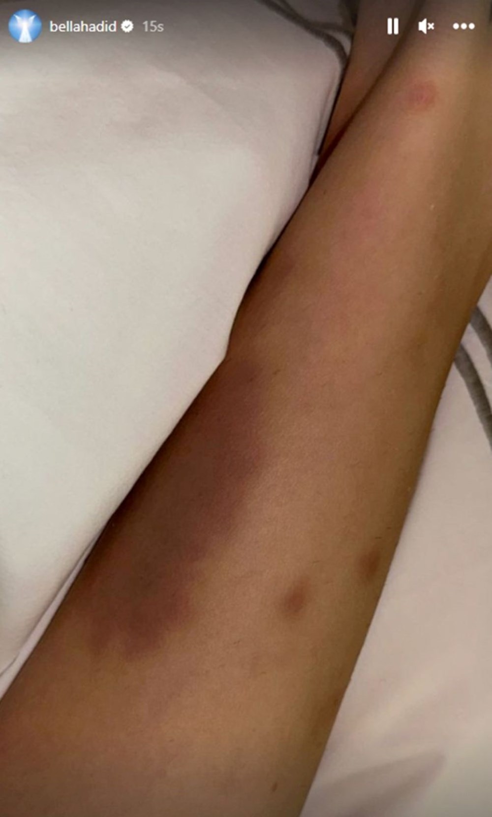 Bella Hadid sosyal medyaya geri döndü - 4