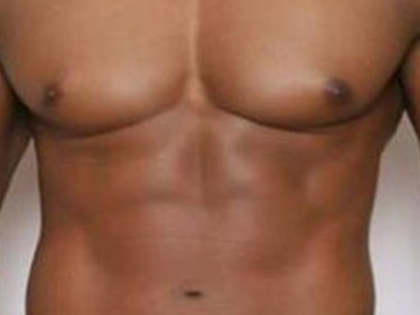 Erkek 1 Saatte Vucuduyla Barisiyor Saglik Haberleri Ntv