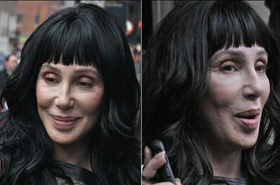 Cher yüz bandıyla gençleşti  - 2