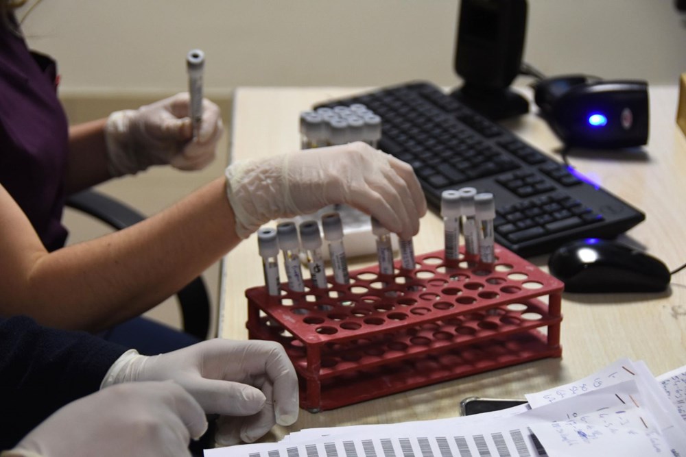 Mutated corona virus cases are detected in 40 minutes - 9
