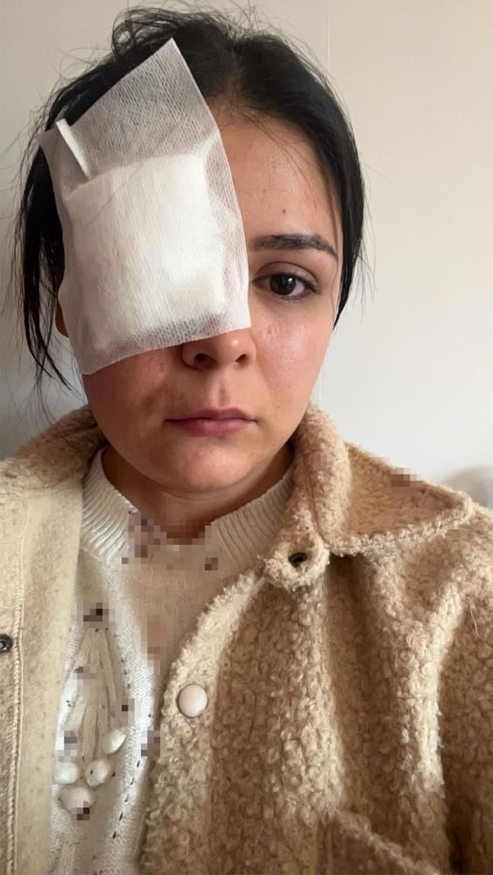 Yolda yürüyen genç kıza yumruklu saldırı - 7