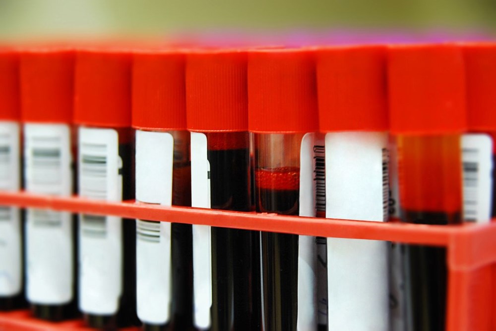 Araştırma: Kan grupları sağlığa dair ipuçları verebilir - 6