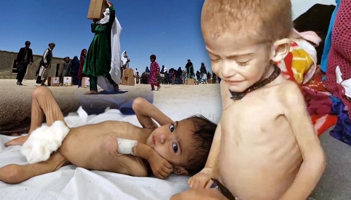 Afganistan'daki açlık krizinin acı yüzü: 3 yaşında ama bir bebek kadar küçük