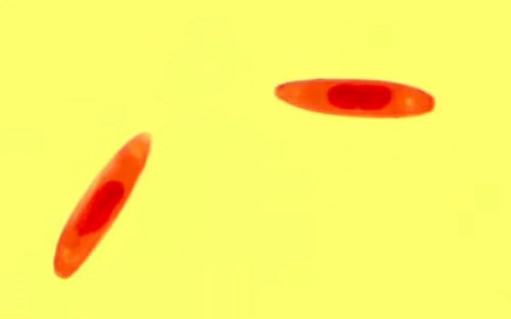 Zombi mantarı İstanbul'da görüldü! İnsanların beynini ele geçirebilir mi? - 4