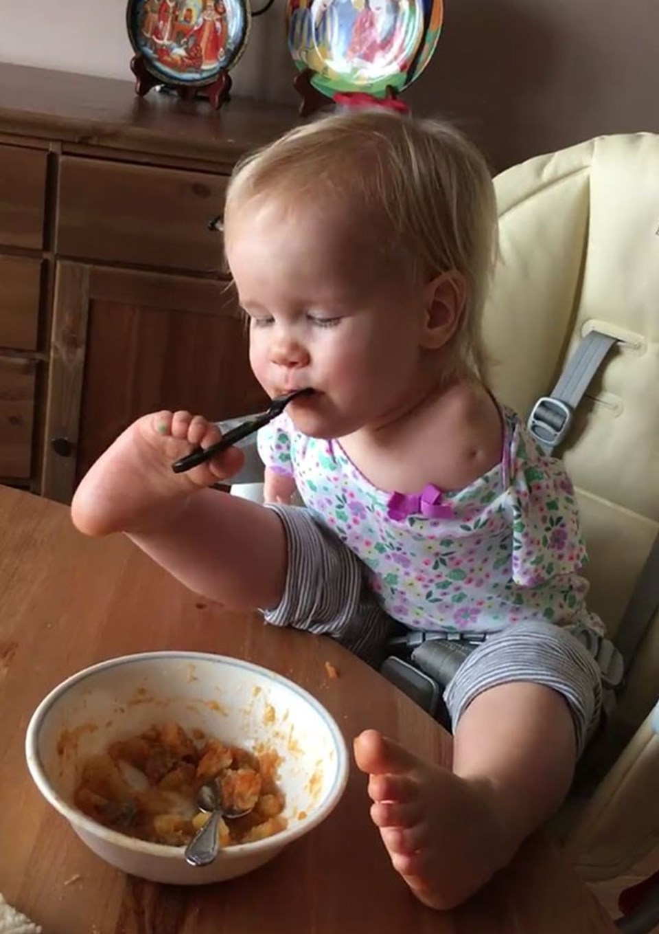 Kolları olmayan bebek ayaklarıyla yemek yemeyi öğrendi - 2