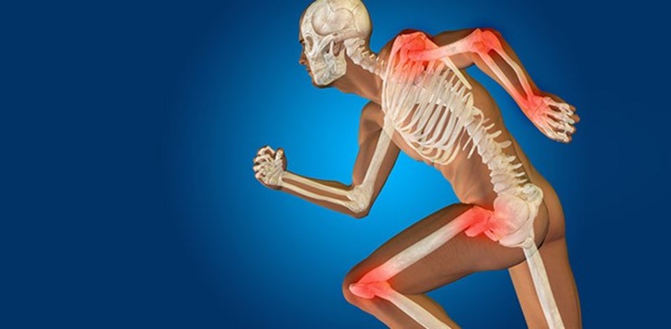 Kemik erimesinden korunmanın 9 yolu (Osteoporoz neden olur?) - 1