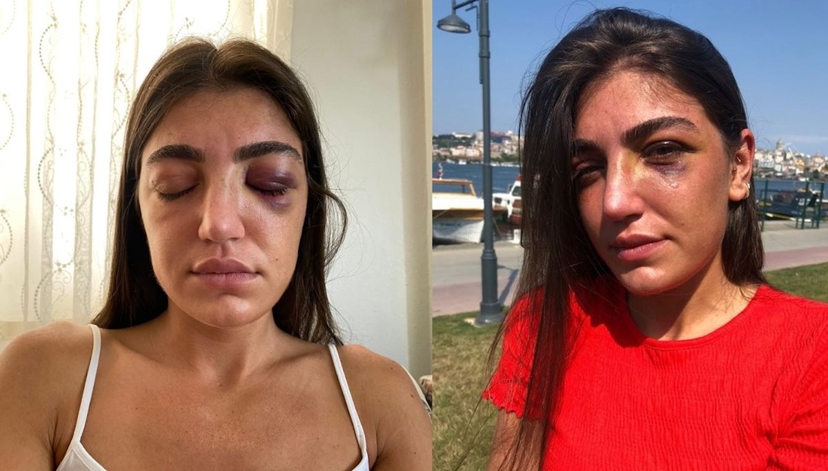 Ünlü mankene öldüresiye dayak