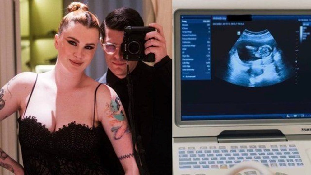 Anne olmak için gün sayan Ireland Baldwin: İçeride kimse var mı? - 2
