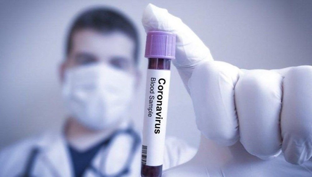 Corona virüse karşı en riskli kan grubu belirlendi - 37