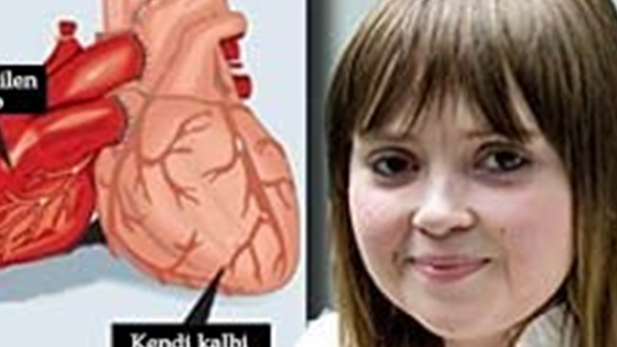 Nakledilen Kalp Calisirken Kendi Kalbi Iyilesti Saglik Haberleri Ntv