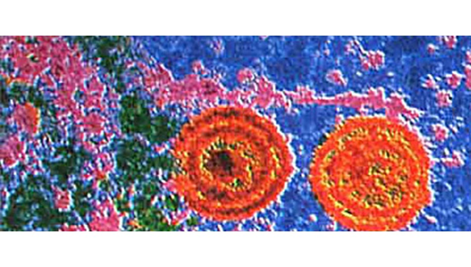 Kansere karşı Herpes virüsü