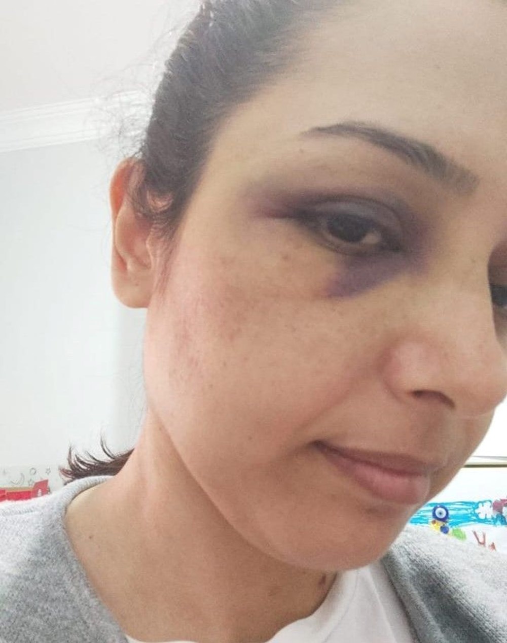 Burcu öğretmenin yardım çığlığı: "Beni bu adamdan kurtarın" - 7