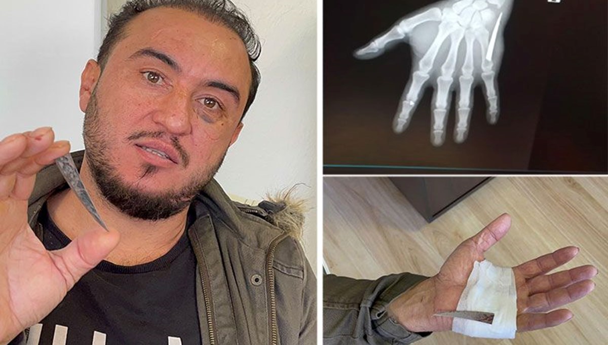 Çektirdiği röntgenle birlikte hayatının şokunu yaşadı Çektirdiği röntgenle birlikte hayatının şokunu yaşadı