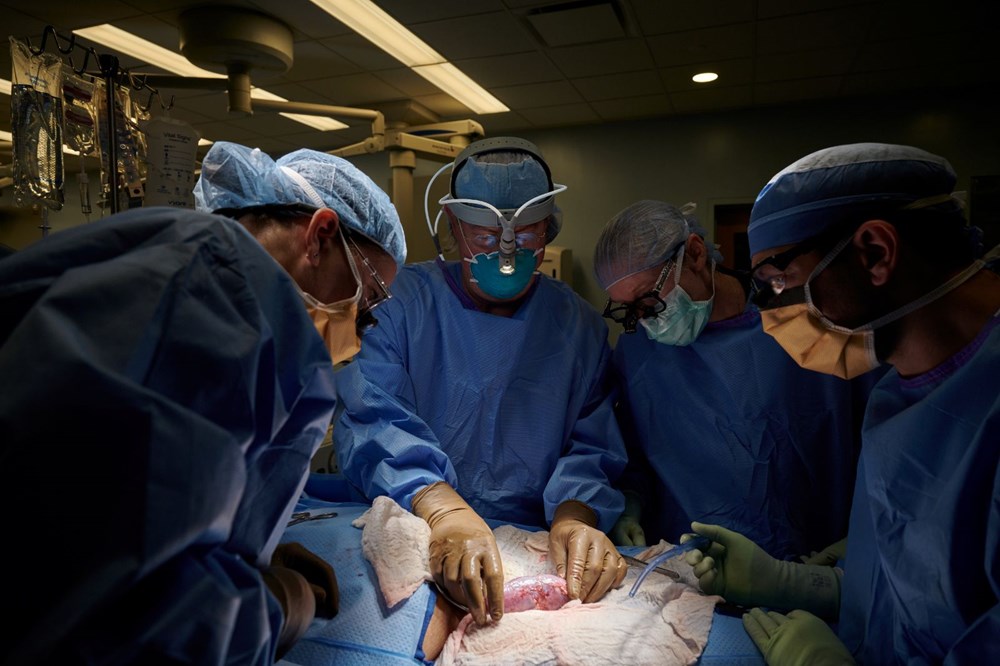 Dünyada ilk kez hayvandan alınan organ bir insana başarıyla nakledildi: Yüz binlerce hayatı kurtarabilir - 2