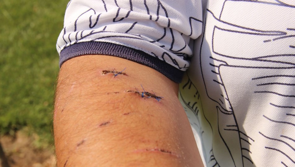 otelde pitbull dehseti tatile gitti