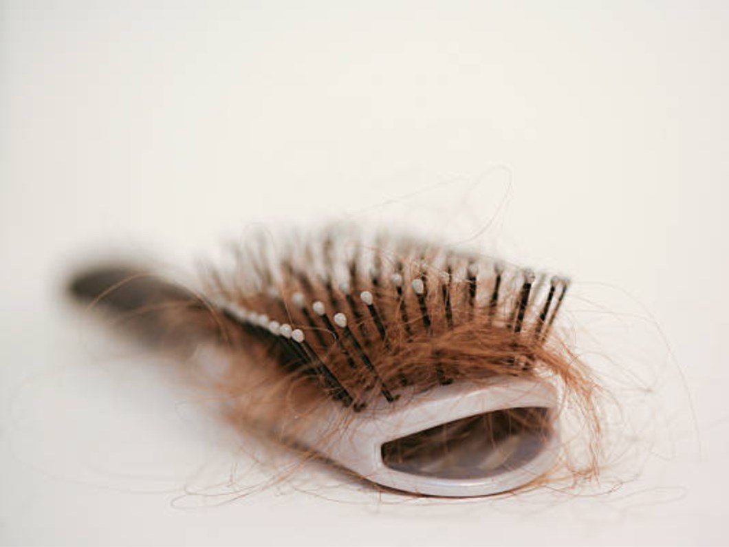 sac dokulmesi baska hastaliklarin belirtisi mi sac dokulmesi neden olur