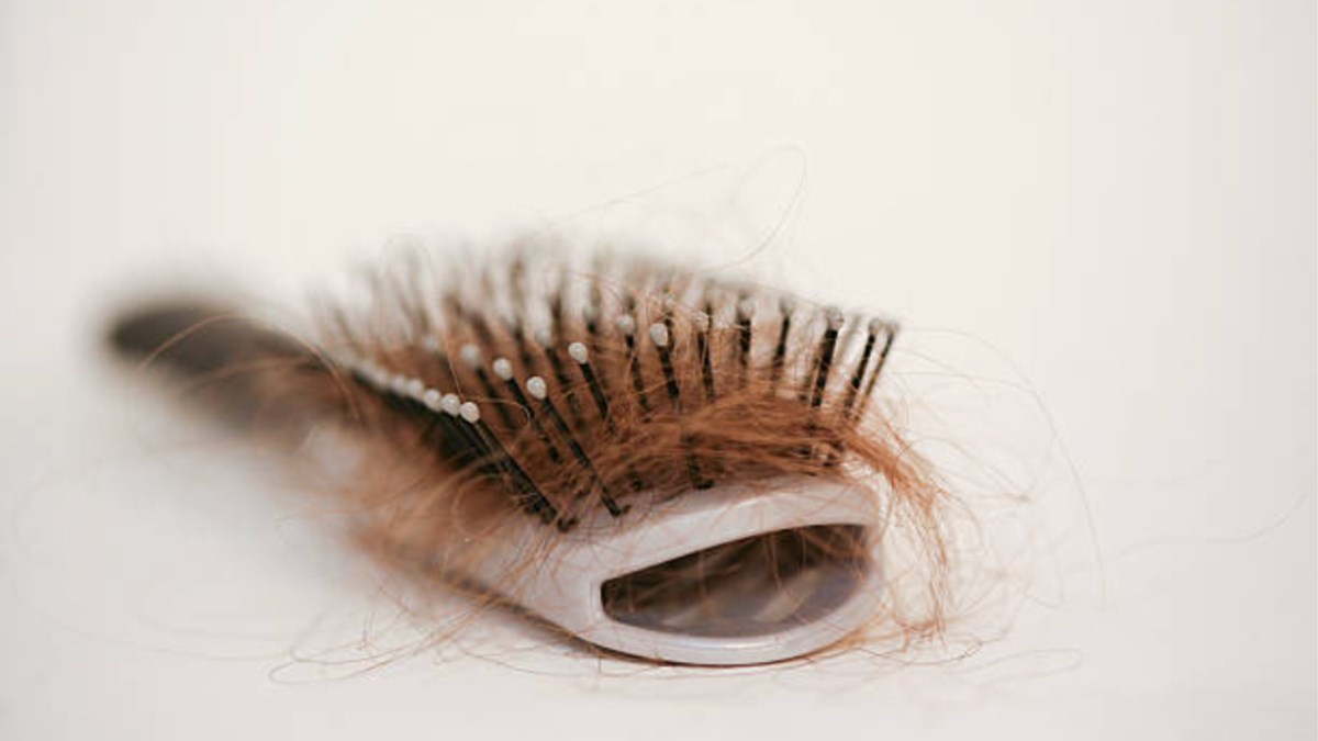 sac dokulmesi baska hastaliklarin belirtisi mi sac dokulmesi neden olur saglik haberleri ntv