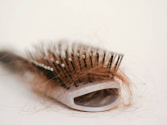 sac dokulmesi baska hastaliklarin belirtisi mi sac dokulmesi neden olur saglik haberleri ntv