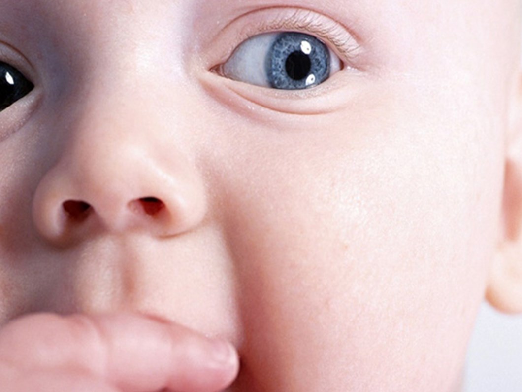 sasilik tedavisinde 8 yas siniri