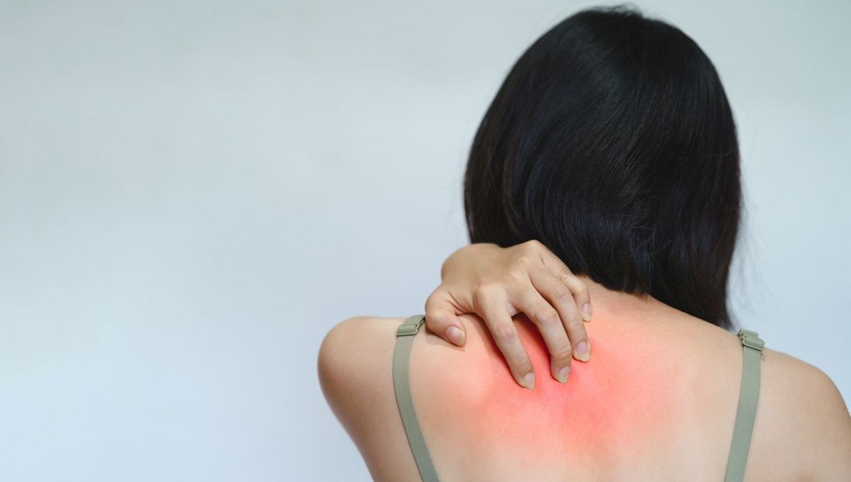 Histamin intoleransı nedir? Histamin intoleransı nedir?