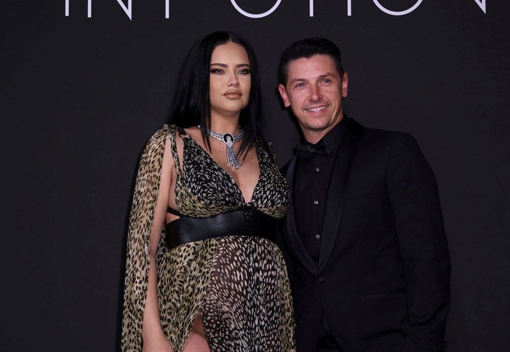 Yüzündeki değişimle şaşırtan Adriana Lima sessizliğini bozdu - 10