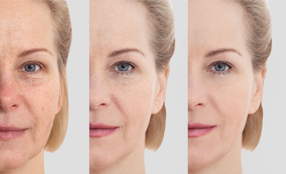 Yaşlanma karşıtı kremler işe yarıyor mu? - 5