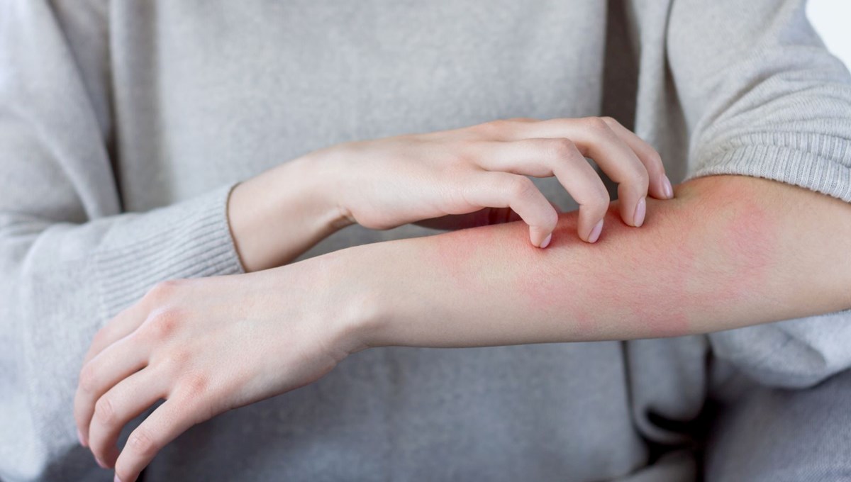 D vitamini eksikliğiniz var mı? Vücuttaki şaşırtıcı işaretler