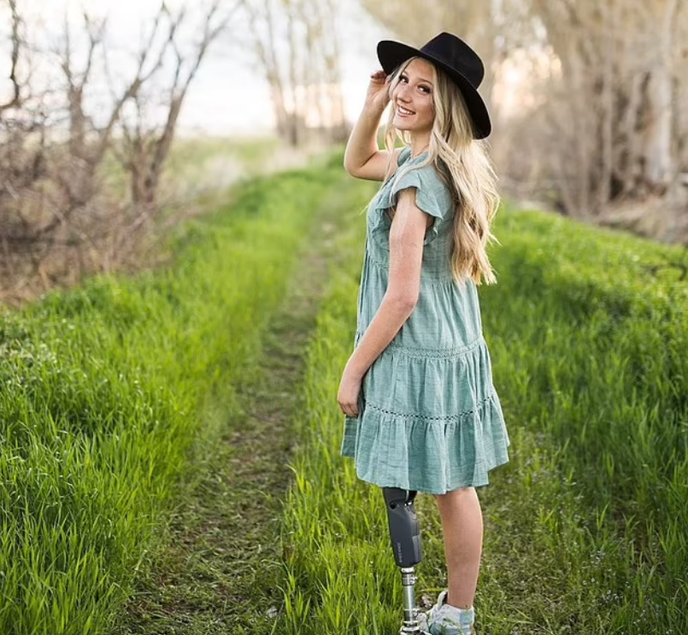 Trafik kazasında arabadan fırlayan genç kız elektrik tellerinde asılı kaldı - 5