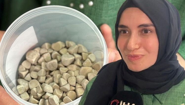 Doktorlar bile şok oldu, nadir görülen bir olay: Vücudundan 287 tane çıkarıldı